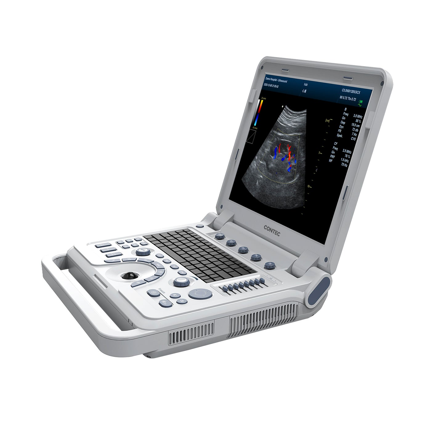 VET Veterinary Portable Ultrasound Scanner Laptop Machine