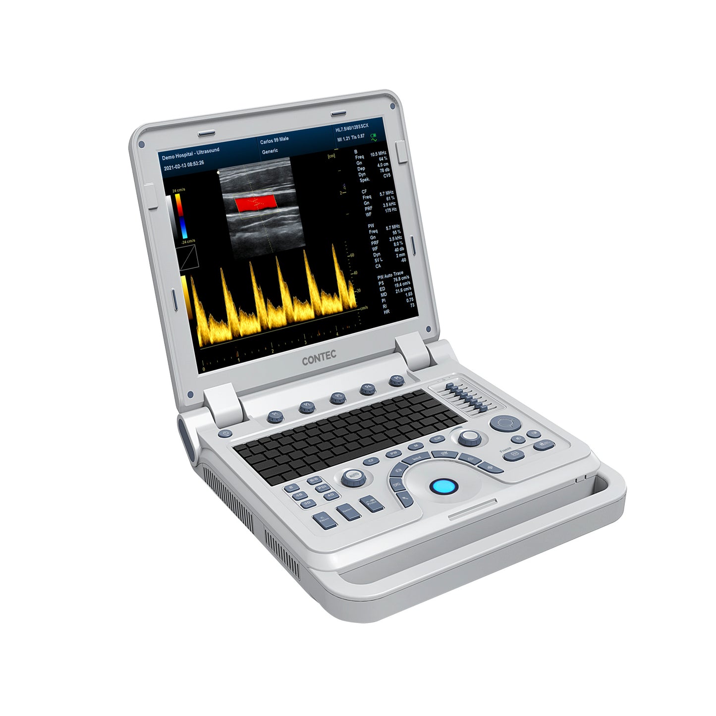 VET Veterinary Portable Ultrasound Scanner Laptop Machine