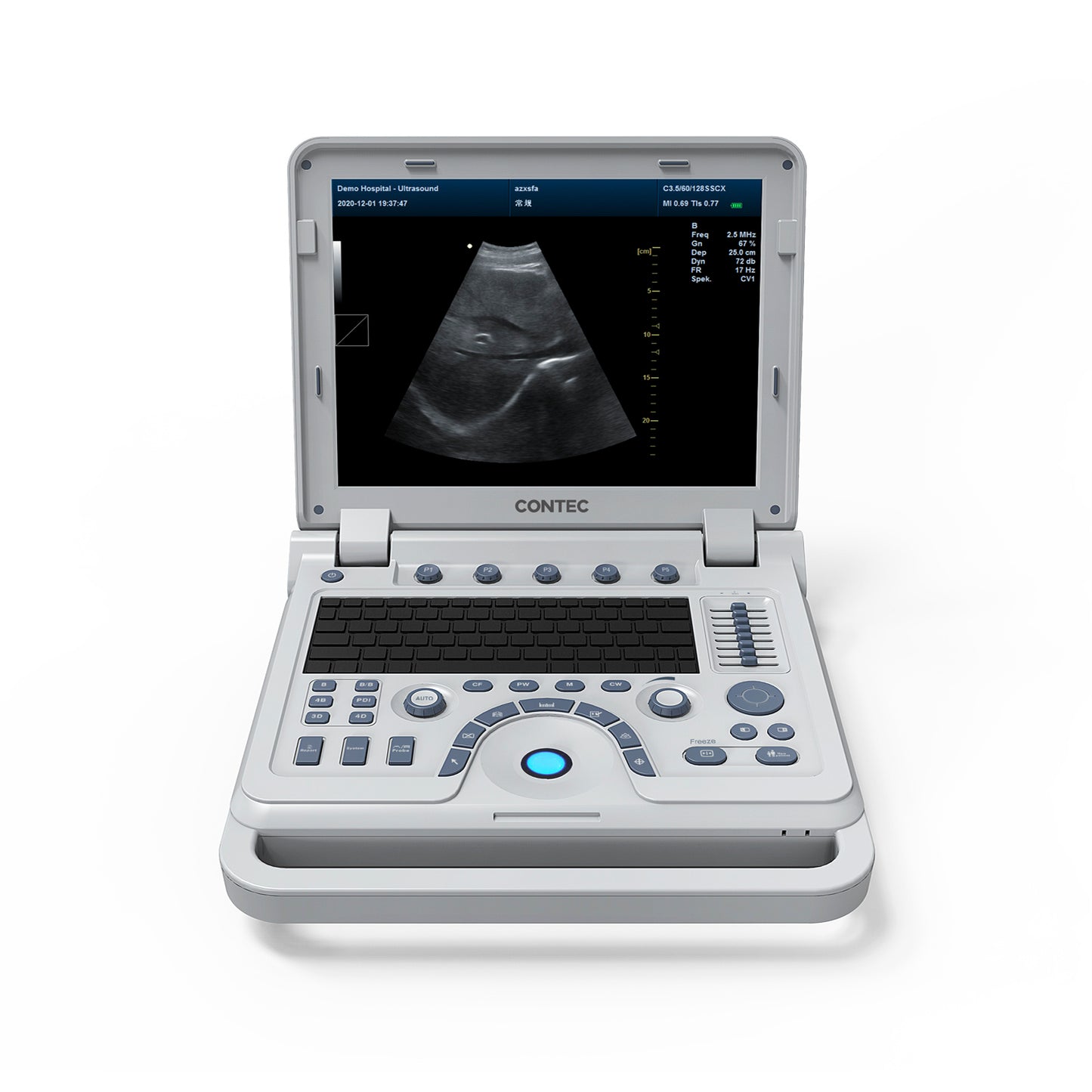 VET Veterinary Portable Ultrasound Scanner Laptop Machine